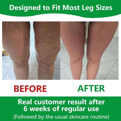 Soulyis Cellulite Manual Push-Pull Roller - Thigh, Calf, Waist Push-Pull Tool - Deep Tissue Pain Relief, Body Sculpting, Anti-Inflammation and Fast Recovery, Pilates Equipment